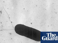 पास्ता भोजन में लिस्टेरिया का प्रकोप 18 अमेरिकी राज्यों में छह मौतों से जुड़ा है | अमेरिकी स्वास्थ्य सेवा