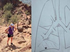 कैसे एक टूटे हुए अंग के कारण एक दशक बाद एक गैर-धूम्रपान करने वाले के फेफड़ों के कैंसर का निदान हुआ